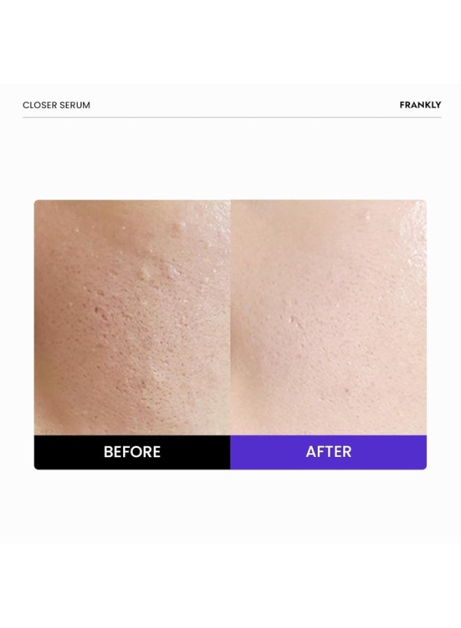 FRANKLY Closer Serum | Pore Minimizer Serum | 9 Peptides, Vegan Collagen, Adenosine, PHA | Korean Pore Minimizer for Glass Skin, Anti-Aging, Hydration, Elasticity | 1.01 fl oz - Image 2